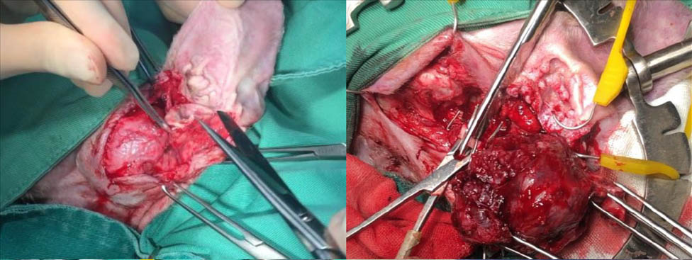 CRP Case 3 - surgery