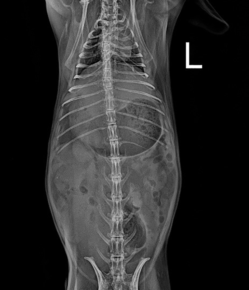 Case 1 X-rays reveal there is a large amount of gas is visible in the stomach