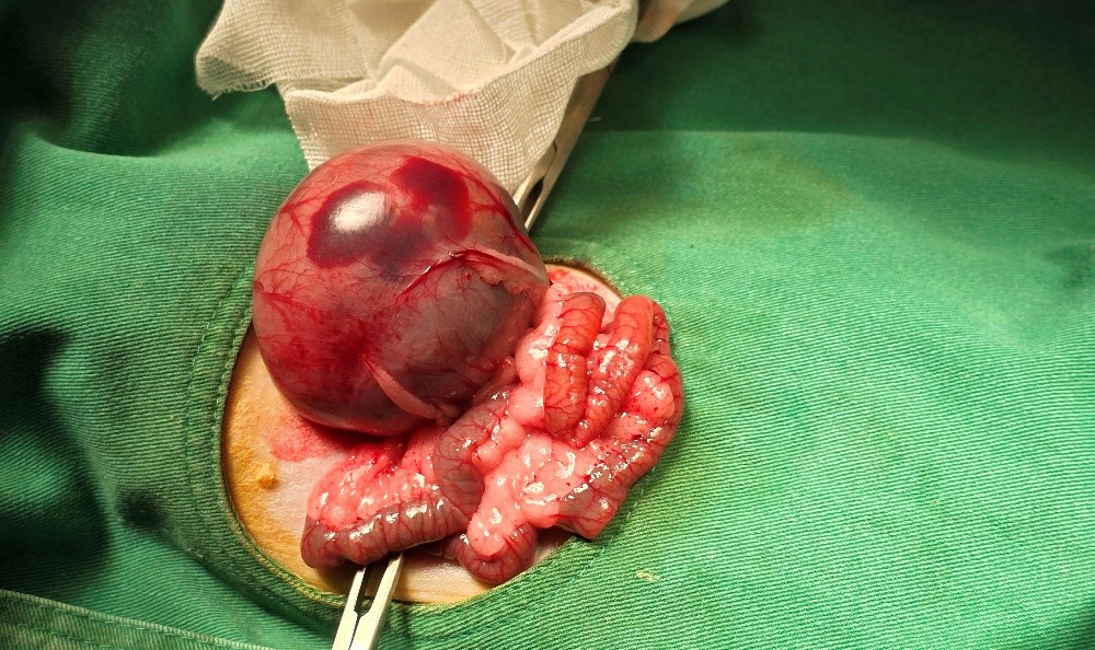 Case 1 Diffuse redness is visible on the serosal surface of the gastrointestinal tract