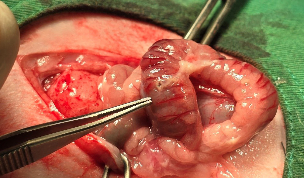 Case 1 Location of foreign body perforation