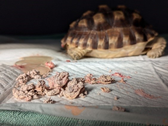The post-operative image of Case 1 shows a large amount of stones being removed