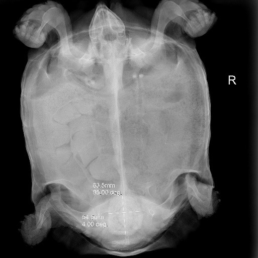 Case 2 X-ray