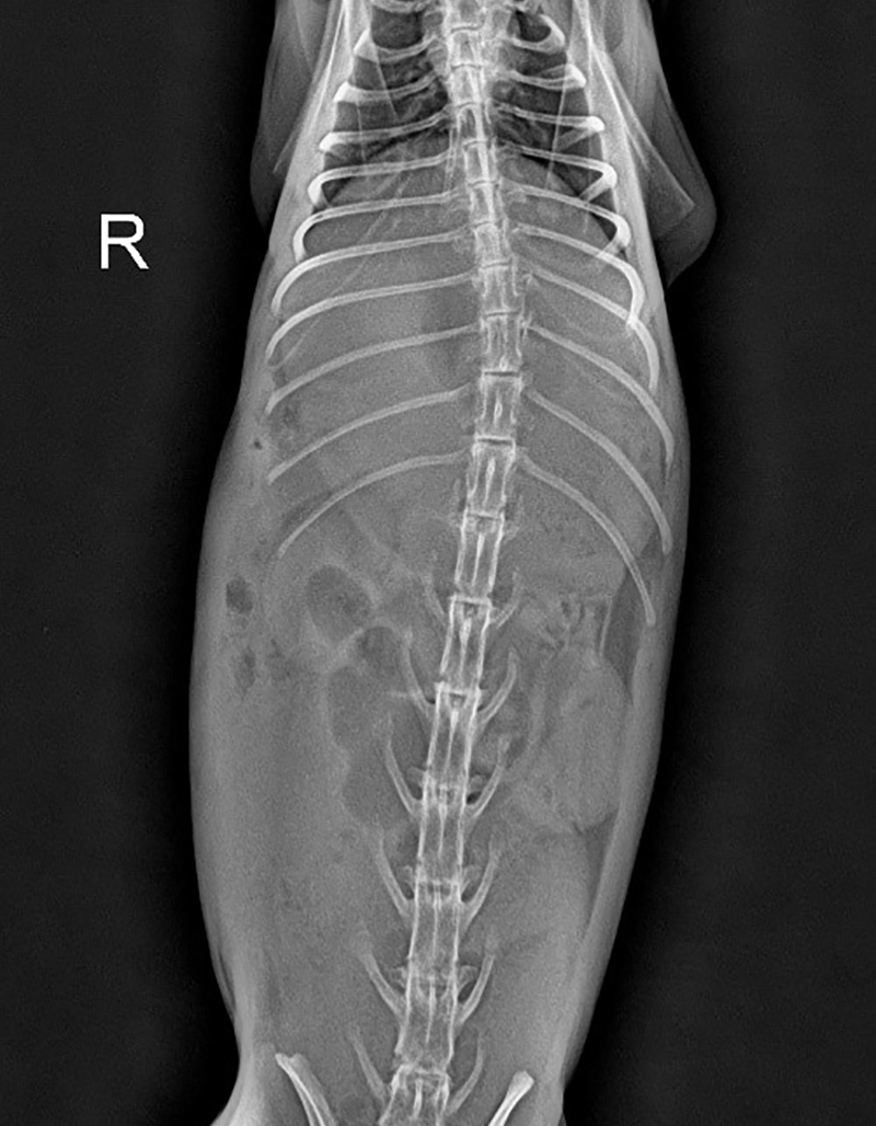 Case 2 Imaging studies revealed a fried egg appearance in the stomach