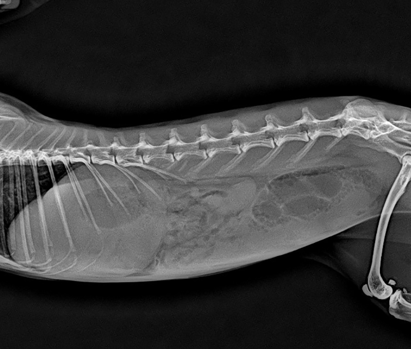 Case 2 Imaging studies revealed a fried egg appearance in the stomach from a side view
