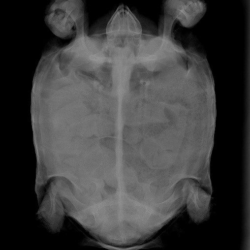 Case 2 Postoperative X-ray