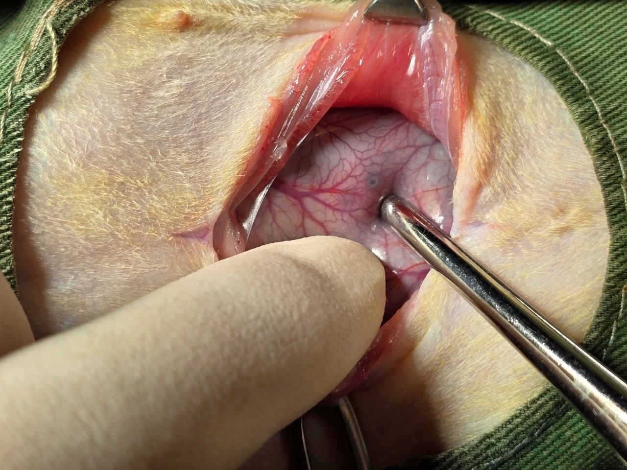 Case 2 Suspected ulceration sites