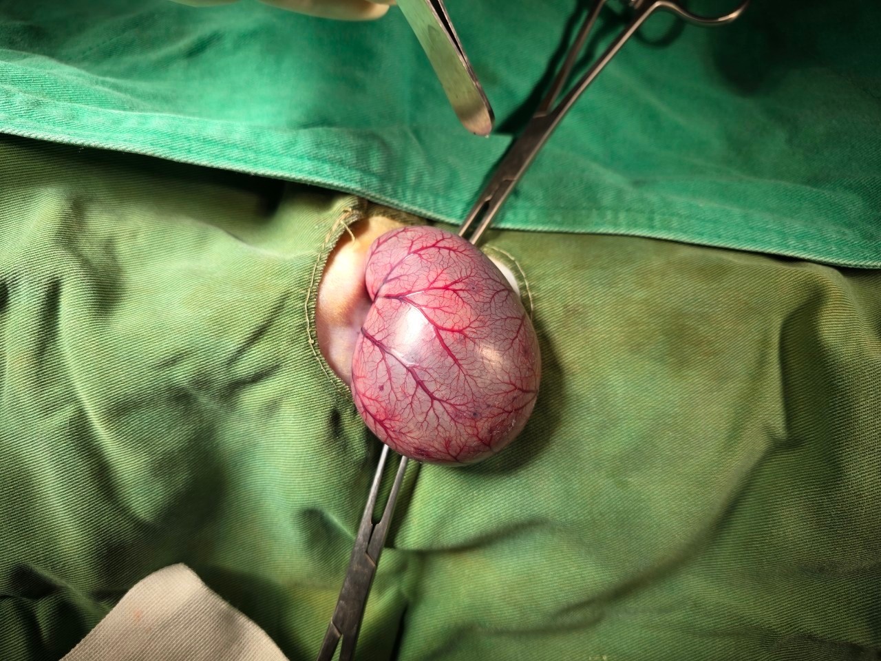 Case 2 The serosal surface of the stomach shows vascular congestion, and suspected multiple localized ulcerations are visible