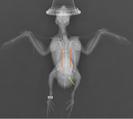 Case 1 VD view