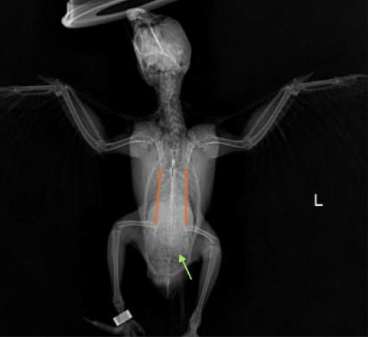 Case 2 VD view