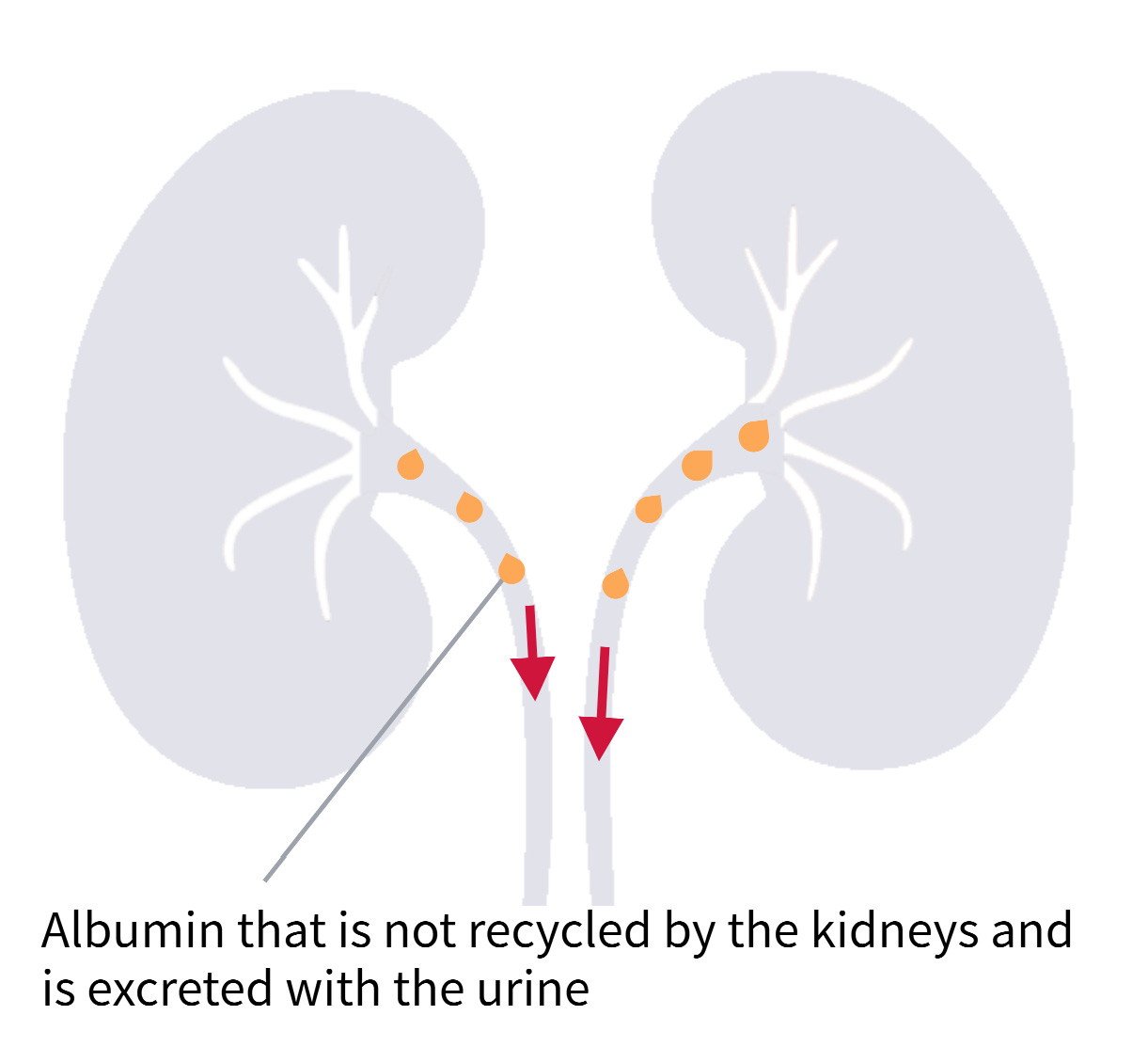 Figure 1: Albumin that is not recycled by the kidneys and is excreted with the urine