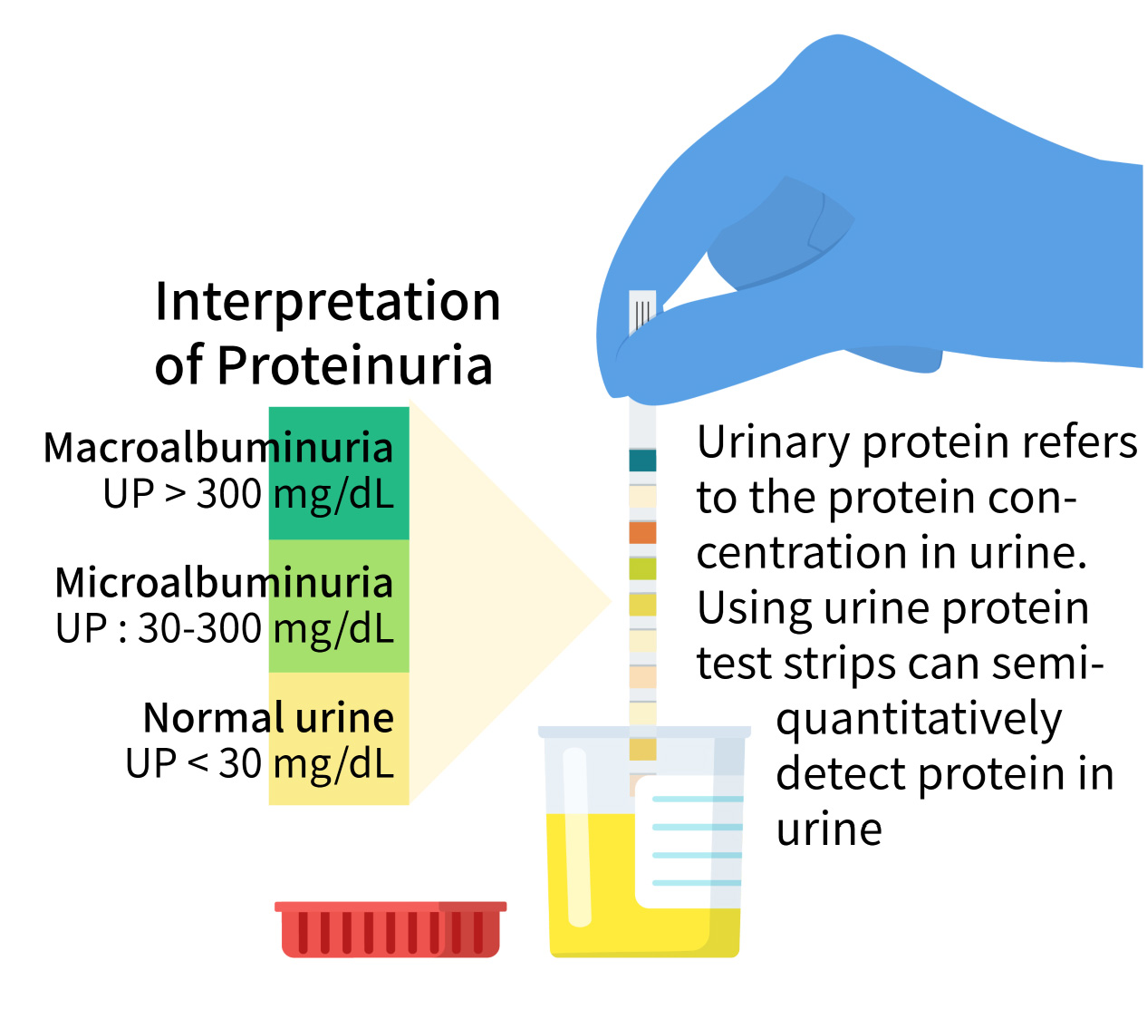 Figure 2: Interpretation of proteinuria
