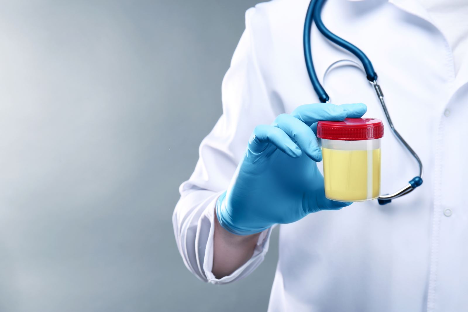 Doctor Holding an Urine sample